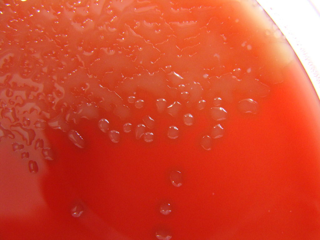 streptococcus pneumoniae