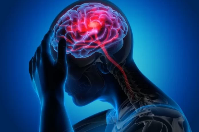 how long does migraine last