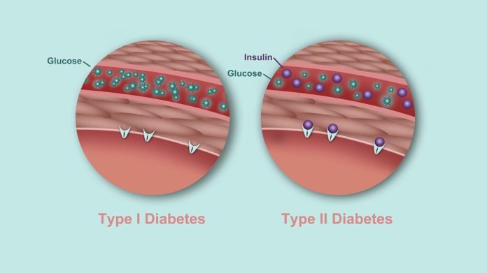 types of diabetes