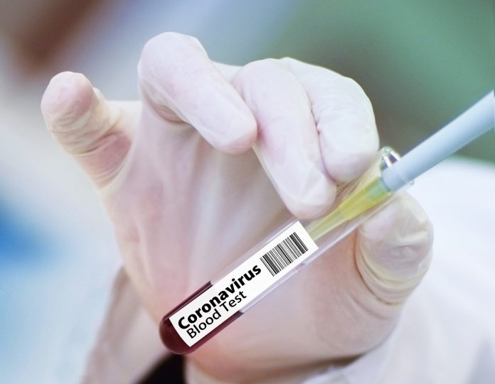 coronavirus cases